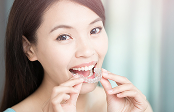 Invisalign
